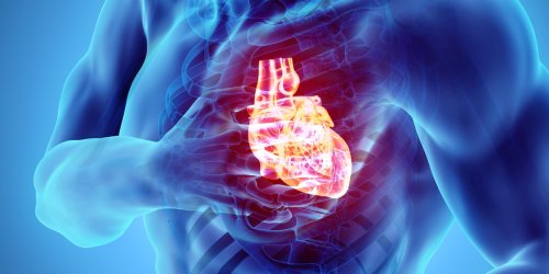 Rettung für Tausende Menschen: Bleibt bei CT unbemerkt: KI erkennt Herzinfarkt-Risiko bis zu 10 Jahre im Voraus