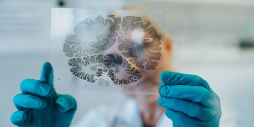„Wichtige Pionierarbeit“: Meilenstein für die Demenz-Forschung: Forscher verjüngen das Gehirn von Mäusen