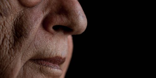 Skurriler Vorfall: Ärzte entfernen 150 Insektenlarven aus Nase ihres Patienten