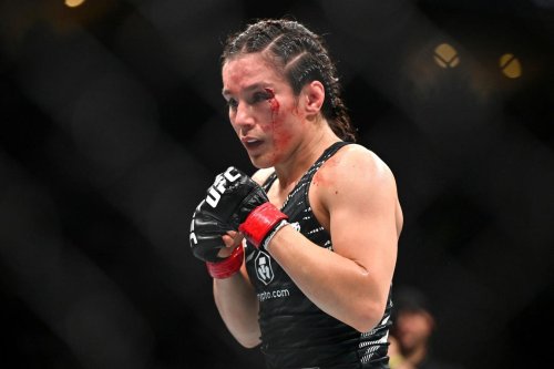 Alexa Grasso Posts Gruesome Post-Fight Image Following UFC 315 Loss