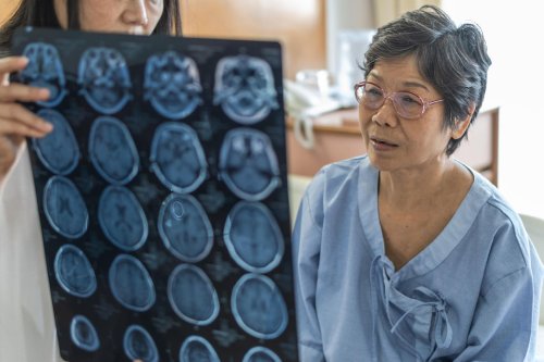 Blue Cross Plans Say Alzheimer’s Has Tripled Among Adults Ages 30 To 64