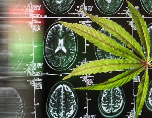 CBD May Help Prevent And Alleviate Alzheimer's Disease, Study Finds