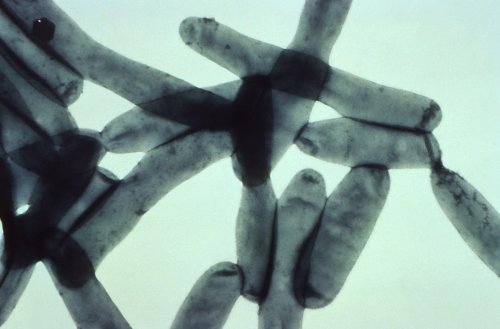 Trump’s NIH And NSF Cuts Estimated To Cost The U.S. Economy $10 Billion Annually