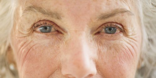 Does Medicare cover cataract surgery? What you need to know