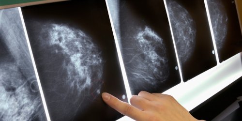 U.S. Panel Says More Women Should Get BRCA Gene Testing for Breast Cancer: Brainstorm Health