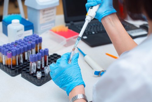 Nuove regole più severe per test e dispositivi in vitro in Ue