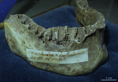 Scientists find scurvy in mouth of long-dead, failed crusader king