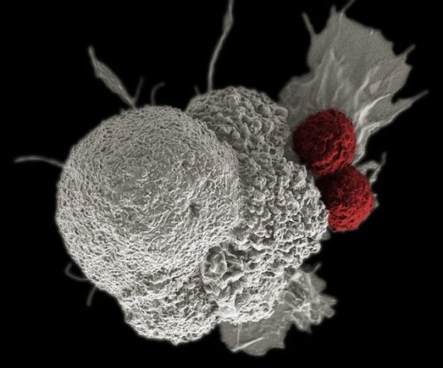 10 Potentially Game-Changing Cancer Immunotherapies You Should Be Following