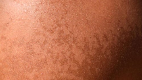 Sonnenbrand durchs Fenster: Sunblocker auch im Auto und Büro?