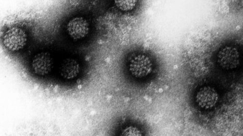 HP-Virus: Fast jeder ist infiziert, die wenigsten entwickeln Krebs – wie Sie Ihr Risiko senken