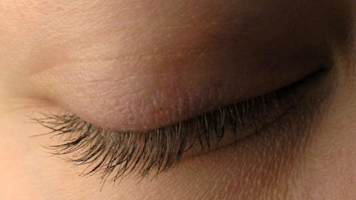 Zuckendes Auge: Fünf ernste Erkrankungen, die dahinter stecken können
