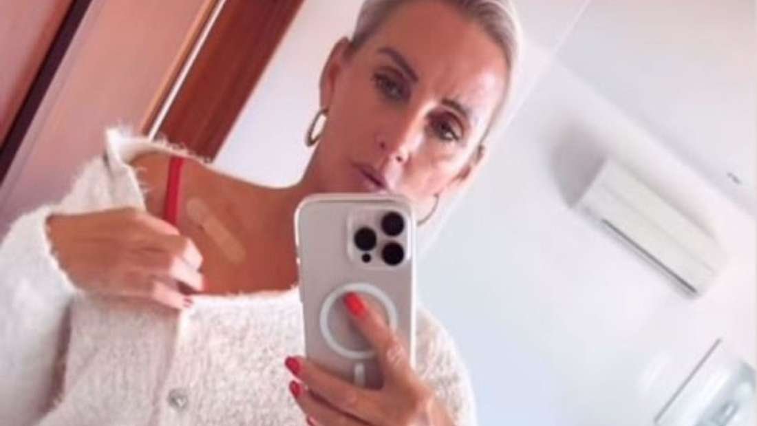 Deutscher TV-Star kämpft gegen Krebs – das sind die Symptome von weißem Hautkrebs