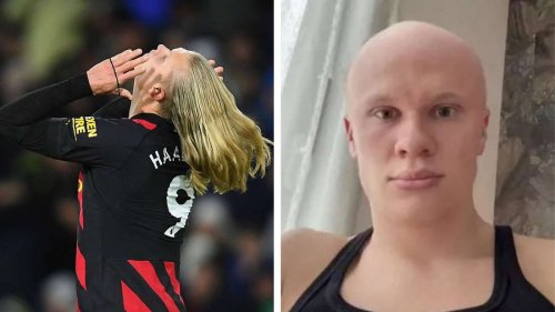 Markenzeichen weg? Fußball-Superstar zeigt sich plötzlich völlig verändert
