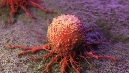 Forschende entdecken Ursache für Entstehung von Metastasen