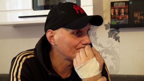 Hartz und herzlich“-Elvis berichtet über Böller-Unfall – und seine Verletzungen