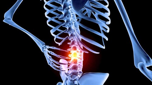 Rückenschmerzen: Oft ist die Lösung ganz einfach