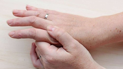 Krebs früh erkennen: Erste Anzeichen an den Fingernägeln sichtbar