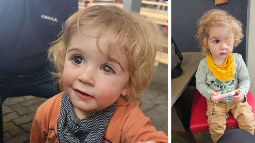 Kind (2) nach Kuss auf einem Auge blind – Mutter warnt andere Eltern eindringlich