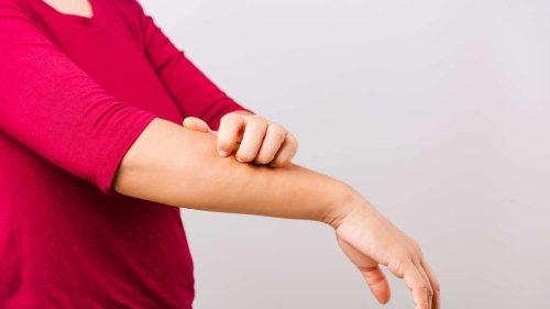 Dermatologin warnt: Bei Juckreiz nicht kratzen – sechs bessere Alternativen