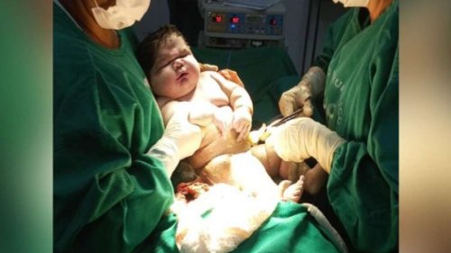 Rekord-Geburt in Brasilien: Mutter bringt Sieben-Kilo-Baby auf die Welt