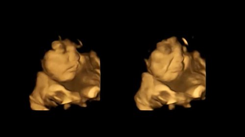 Lächeln bei Karotten: 4D-Ultraschall zeigt, was Babys gerne essen