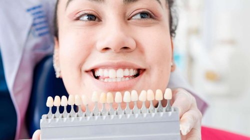 Zahnzusatzversicherung abschließen: Was sind die Risiken und Vorteile?