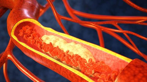 Nicht nur das Herz – schwankendes Cholesterin kann diese wichtige Funktion im Körper beeinträchtigen
