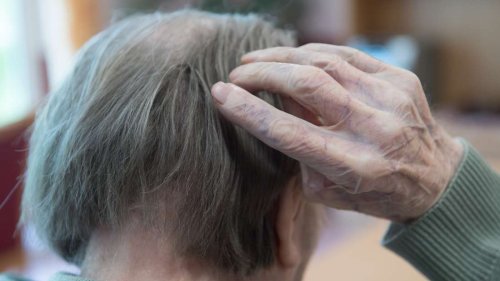 Alzheimer-Medikament bremst geistigen Verfall – „Historischer Moment für die Demenz-Forschung“