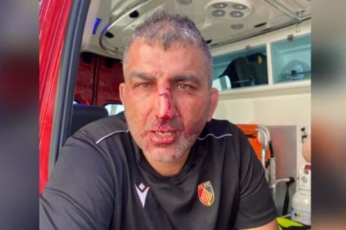 VIDÉO. "Six fractures de la face", nez et dents cassés, au moins 11 joueurs blessés lors d'une violente bagarre après un match de rugby régional