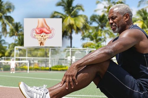 SPORT-SANTE : soulager les douleurs de l’arthrose par le mouvement