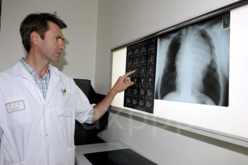 CHU de Toulouse : un traitement prometteur contre le cancer du poumon