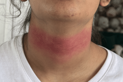 “Étranglée dans la cour de récréation”, une collégienne porte plainte après la violente agression dont elle a été victime