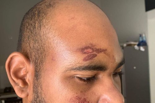 Un Mahorais et un Guadeloupéens passés à tabac en marge d’une fête de village : les trois agresseurs présumés comparaissent vendredi 2 juin à Carcassonne