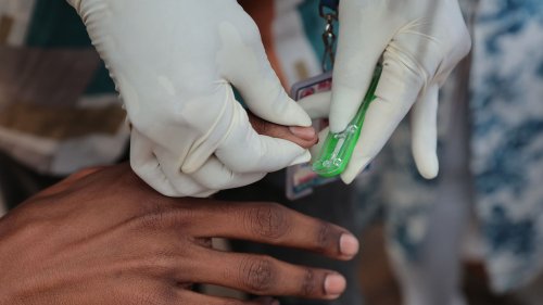 Lutte contre le sida : entre 770 000 et 2,9 millions de morts possibles d'ici 2030 dans le monde à cause de la baisse de financement international