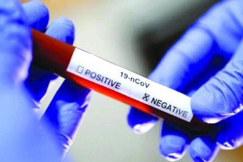 Covid-19 en Martinique : 634 nouveaux cas, la circulation du virus reste "active"