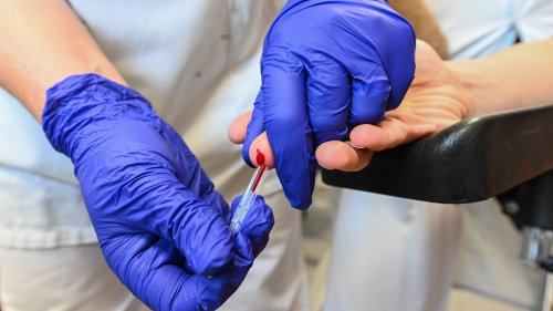 40 ans de la découverte du virus du Sida : il y a "5000 découvertes de séropositivité chaque année en France", selon le Sidaction