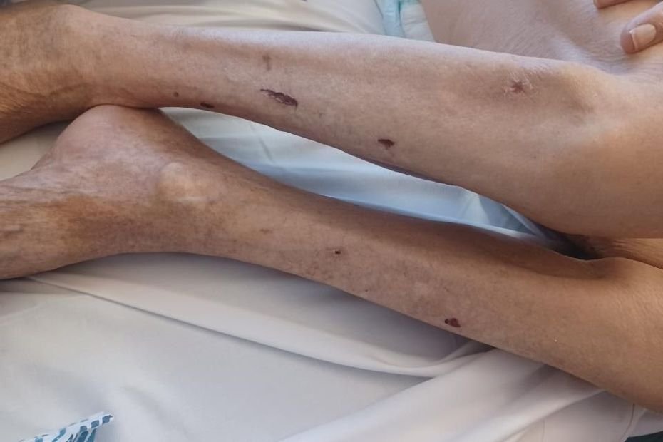 "C'est désarmant, ça me refroidit", une famille raconte sa souffrance face un système de soin défaillant