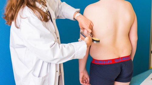 Pour prévenir l'obésité infantile, une mission parlementaire préconise de mesurer et peser les élèves en CE2