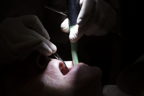 VIH et hépatite B : suite à des soins dentaires à Lyon, des milliers de patients invités à se faire dépister