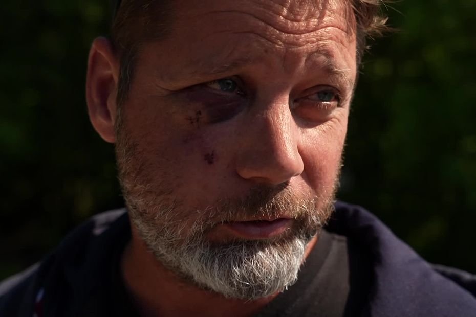 "Ils ont tout de suite attaqué, une horde sauvage" : un élu violemment agressé en tentant d'arrêter un rodéo urbain