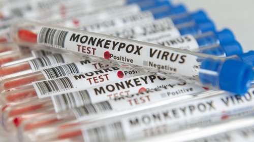 Variole du singe : l'OMS appelle à la vigilance après la contamination d'un chien par la variole du singe