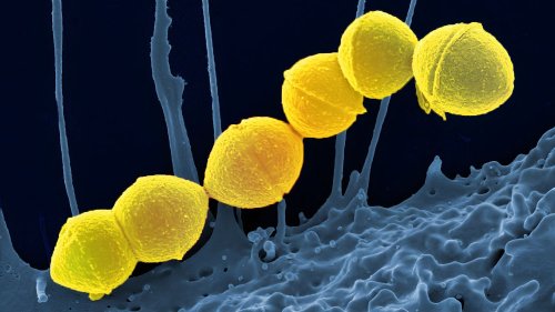 Ce que l'on sait de la bactérie "mangeuse de chair" qui inquiète le Japon