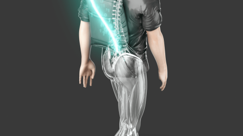 Neurosciences : un paraplégique parvient à remarcher en contrôlant le mouvement de ses jambes par la pensée