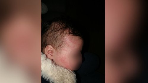 Témoignage "C'est atroce de vivre une chose pareille" : des parents dénoncent des soupçons de maltraitance dans des crèches People & Baby