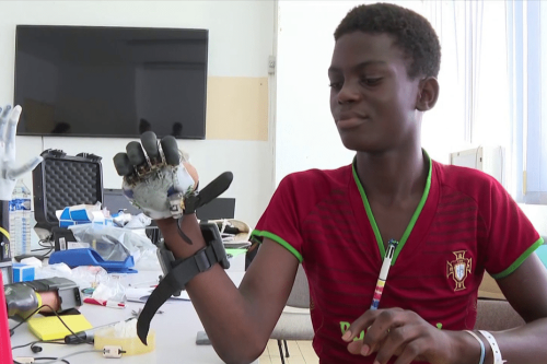 Deux adolescents bénéficient des premières prothèses myoélectriques posées en Guyane