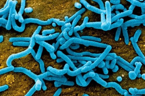Tanzanie : un virus dangereux fait son apparition