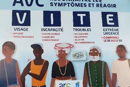 L’Accident Vasculaire Cérébral fait des victimes en Guadeloupe