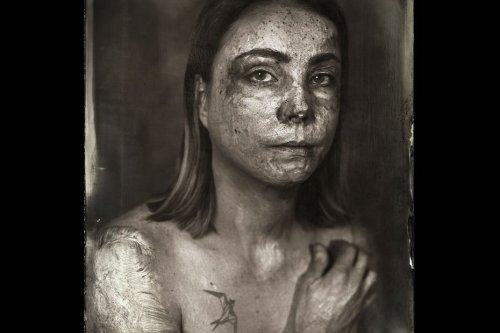"Quand est-ce que vous avez vu un brûlé dans la rue ?" : le photographe Clément Marion expose ses portraits à Besançon