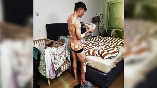 Cyclisme : Primoz Roglic dévoile une photo de son corps recouvert de pansements après ses chutes au Tour du Pays basque