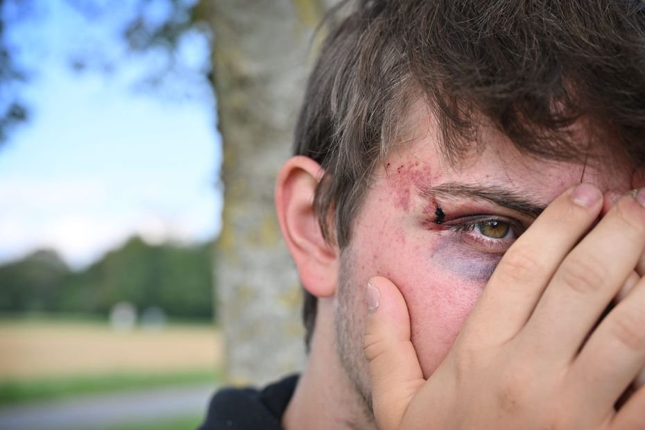 Agressé car homosexuel : la justice condamne trois mineurs à 7 mois de prison avec sursis pour agression à caractère homophobe